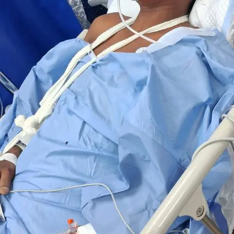 Man in Fairfield accident facing serious medical issues, no charge yet